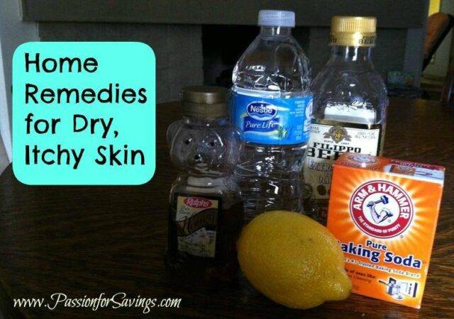Home Remedies for Dry, Itchy Skin