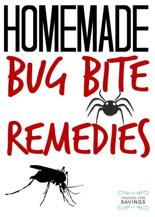 homemade bug bite remedies