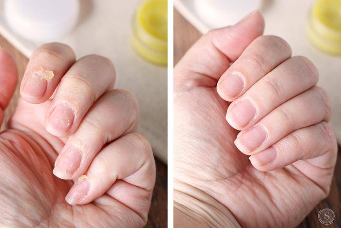 This homemade cuticle cream recipe is perfect anytime, but I like to apply it just before bedtime so it can work it's magic overnight.